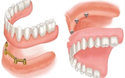 Çene Özel Diş Sağlığı Ltd. Şti. Tasfiye Halinde